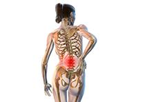 „Volkskrankheit“ Rückenschmerzen: Skalpell häufig nicht die richtige Wahl